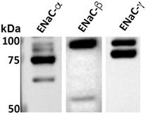 Epithelial Sodium Channel-α Mediates the Protective Effect of the TNF-Derived TIP Peptide in Pneumolysin-Induced Endothelial Barrier Dysfunction